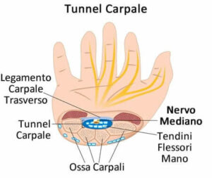 Una persona riceve un massaggio miofasciale per trattare la sindrome del tunnel carpale, una condizione che causa dolore, intorpidimento e formicolio ai nervi del polso e della mano
